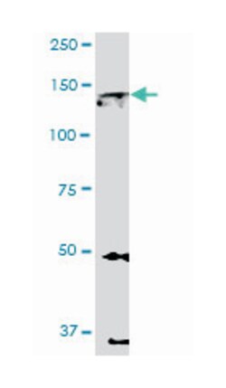 EPH receptor A2, Mouse, Clone: 1E3, Abnova 100 &mu;g | Buy Online | Abnova | Fisher Scientific