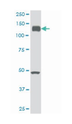 EPH receptor A2, Mouse, Clone: 1E3, Abnova 100 &mu;g | Buy Online | Abnova | Fisher Scientific