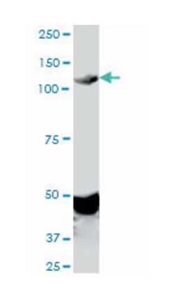 EPH receptor A2, Mouse, Clone: 1E3, Abnova 100 &mu;g | Buy Online | Abnova | Fisher Scientific