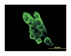 EPH receptor A2, Mouse, Clone: 1E3, Abnova 100 &mu;g | Buy Online | Abnova | Fisher Scientific