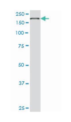 EIF4G1, Mouse, Clone: 3A10, Abnova 100 &mu;g | Buy Online | Abnova | Fisher Scientific