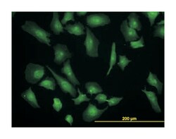 eukaryotic translation initiation factor 4 gamma, 1, Mouse, Clone: 2A9,