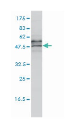EIF5, Mouse, Clone: 2E6-4C12, Abnova 100&mu;g; Unlabeled:Anticorps, Monoclonal