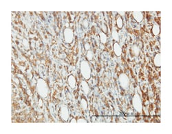 EIF5, Mouse, Clone: 2E6-4C12, Abnova 100&mu;g; Unlabeled:Anticorps, Monoclonal