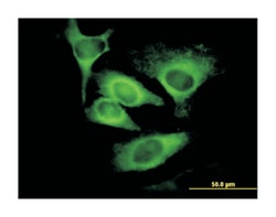 EIF5, Mouse, Clone: 2E6-4C12, Abnova 100&mu;g; Unlabeled:Anticorps, Monoclonal
