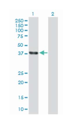 ELAV (embryonic lethal, abnormal vision, Drosophila)-like 4 (Hu antigen