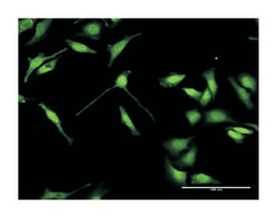 ELAV (embryonic lethal, abnormal vision, Drosophila)-like 4 (Hu antigen