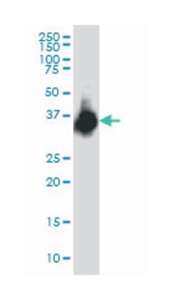 ELAVL4, Mouse, Clone: 6B9, Abnova 100&mu;g; Unlabeled:Antibodies, Monoclonal