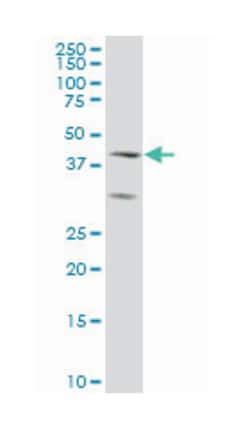 ELF3, Mouse, Clone: 1D8, Abnova 100&mu;g; Unlabeled:Antibodies, Monoclonal