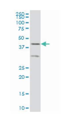 ELF3, Mouse, Clone: 2G9, Abnova&trade;