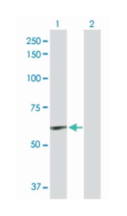 elastin, Rabbit, Purified MaxPab Polyclonal Antibody, Abnova 100&mu;g;