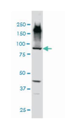 echinoderm microtubule associated protein like 1, Mouse, Clone: 5G3, Abnova