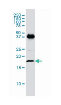 EMP3, Mouse, Clone: 3D4, Abnova 100&mu;g; Unlabeled:Antikörper