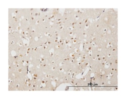 EMX2, Mouse, Clone: 4F7, Abnova 100&mu;g; Unlabeled:Antibodies, Monoclonal
