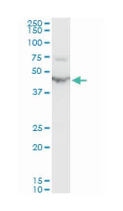 enolase 1, (alpha), Mouse, Polyclonal Antibody, Abnova 50 &mu;L | Buy Online | Abnova Corporation | Fisher Scientific