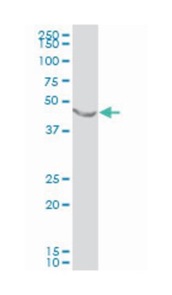 enolase 1, (alpha), Mouse, Polyclonal Antibody, Abnova 50 &mu;L | Buy Online | Abnova Corporation | Fisher Scientific