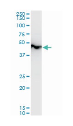 enolase 1, (alpha), Mouse, Polyclonal Antibody, Abnova 50 &mu;L | Buy Online | Abnova Corporation | Fisher Scientific