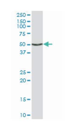 ENO1, Mouse, Clone: 9E4, Abnova 100&mu;g; Unlabeled:Antibodies, Monoclonal