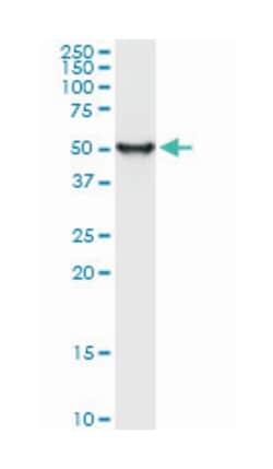 ENO1, Mouse, Clone: 9E4, Abnova 100&mu;g; Unlabeled:Antibodies, Monoclonal