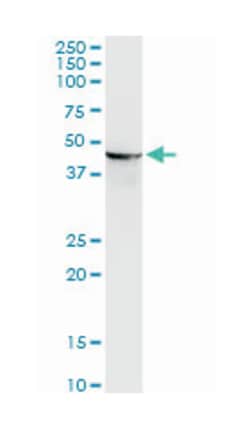 ENO1, Mouse, Clone: 9E4, Abnova 100&mu;g; Unlabeled:Antibodies, Monoclonal