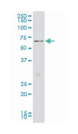 forkhead box O1, Mouse, Clone: 3A10, Abnova&trade;