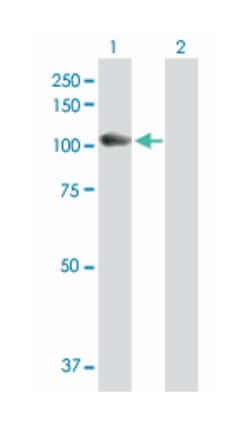 glucosidase, alpha; acid, Rabbit, Purified MaxPab Polyclonal Antibody,