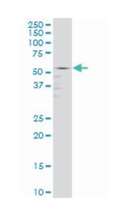 GABPA, Mouse, Clone: 5C8, Abnova 100 &mu;g | Buy Online | Abnova Corporation | Fisher Scientific