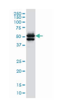 GATA2, Mouse, Clone: 2F12, Abnova 200&mu;L; Unlabeled:Antibodies, Monoclonal