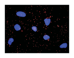 glycogen synthase kinase 3 beta, Mouse, Clone: 1H3, Abnova&trade;