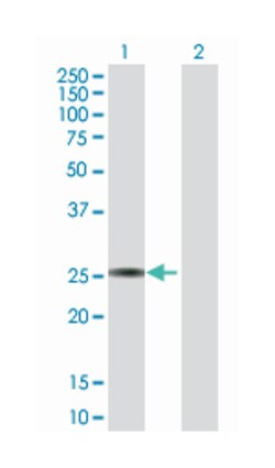 glutathione S-transferase alpha 3, Rabbit, Purified MaxPab Polyclonal Antibody, Abnova 100 &mu;g | Buy Online | Abnova | Fisher Scientific
