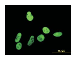 GTF2I, Mouse, Polyclonal Antibody, Abnova 50 &mu;L | Buy Online | Abnova | Fisher Scientific