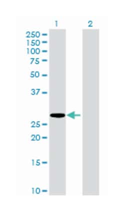 major histocompatibility complex, class II, DM alpha, Mouse, Polyclonal