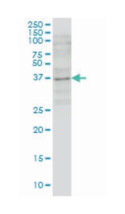 GBX2, Mouse, Clone: 1A7, Abnova 100&mu;g; Unlabeled:Antibodies, Monoclonal