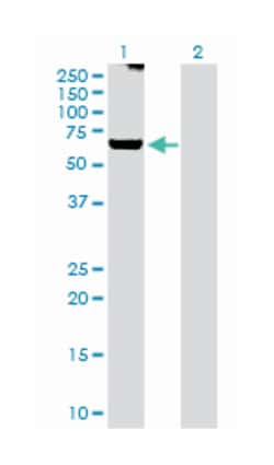 G protein-coupled receptor kinase 6, Rabbit, Purified MaxPab Polyclonal Antibody, Abnova 100 &mu;g | Buy Online | Abnova Corporation | Fisher Scientific
