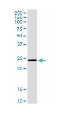 GSTA4, Rabbit, Purified MaxPab Polyclonal Antibody, Abnova 100 &mu;g | Buy Online | Abnova Corporation | Fisher Scientific
