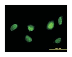 HNF4A, Mouse, Polyclonal Antibody, Abnova 50 &mu;g | Buy Online | Abnova | Fisher Scientific