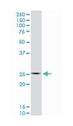 homeobox C12, Mouse, Clone: 1C6, Abnova 100&mu;g; Unlabeled:Antibodies,