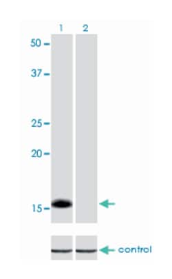 inhibitor of DNA binding 1, dominant negative helix-loop-helix protein,