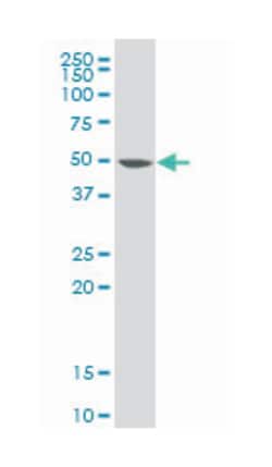 isocitrate dehydrogenase 2 (NADP+), mitochondrial, Mouse, Polyclonal Antibody,