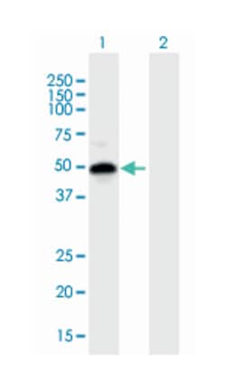interferon regulatory factor 1, Mouse, Polyclonal Antibody, Abnova 50 &mu;L | Buy Online | Abnova | Fisher Scientific