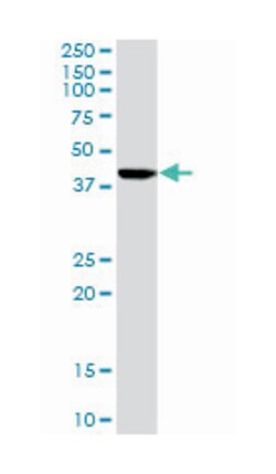 ISL LIM homeobox 1, Rabbit, Purified MaxPab Polyclonal Antibody, Abnova