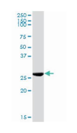 ketohexokinase (fructokinase), Rabbit, Purified MaxPab Polyclonal Antibody,
