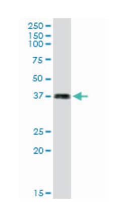 LFNG O-fucosylpeptide 3-beta-N-acetylglucosaminyltransferase, Rabbit, Purified MaxPab Polyclonal Antibody, Abnova 100 &mu;g | Buy Online | Abnova | Fisher Scientific