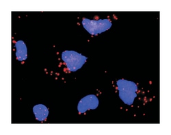 SMAD family member 4, Mouse, Clone: 3E2, Abnova 100&mu;g; Unlabeled:Antibodies,
