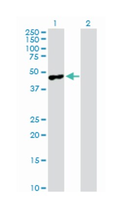 melanoma antigen family A, 4, Rabbit, Purified MaxPab Polyclonal Antibody, Abnova 100 &mu;g | Buy Online | Abnova | Fisher Scientific