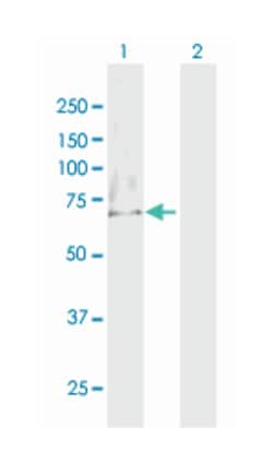 MTM1, Mouse, Polyclonal Antibody, Abnova 50&mu;g; Unlabeled:Antibodies,
