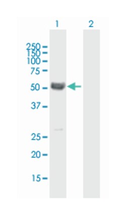 MYOC, Mouse, Polyclonal Antibody, Abnova 50&mu;g; Unlabeled:Antibodies,