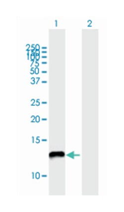 NADH dehydrogenase (ubiquinone) 1 alpha subcomplex, 5, 13kDa, Mouse, Polyclonal Antibody, Abnova 50 &mu;L | Buy Online | Abnova Corporation | Fisher Scientific