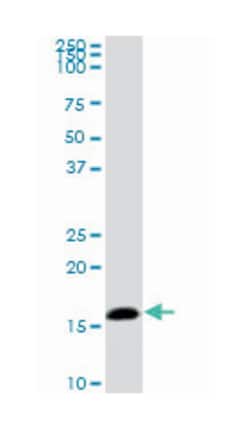 nonmetastatic cells 2, protein (NM23B) expressed in, Mouse, Clone: 1D3, Abnova 100 &mu;g | Buy Online | Abnova Corporation | Fisher Scientific