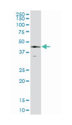 serpin peptidase inhibitor, clade E (nexin, plasminogen activator inhibitor type 1), member 1 (B01), Mouse anti-Human, Polyclonal Antibody, Abnova 50 &mu;L | Buy Online | Abnova | Fisher Scientific